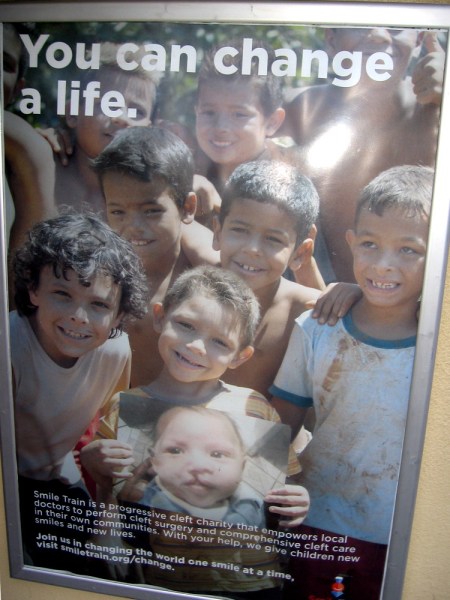 Smile Train is a charity that helps local doctors perform cleft surgery for children around the world.